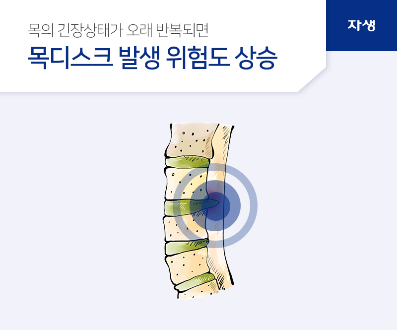 목의 긴장상태가 오래 반복되면 목디스크 발생 위험도 상승 | 자생의료재단