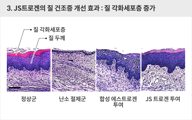 JS트로겐의 질 건조증 개선 효과 : 질 각화세포층 증가 | 자생한방병원·자생의료재단