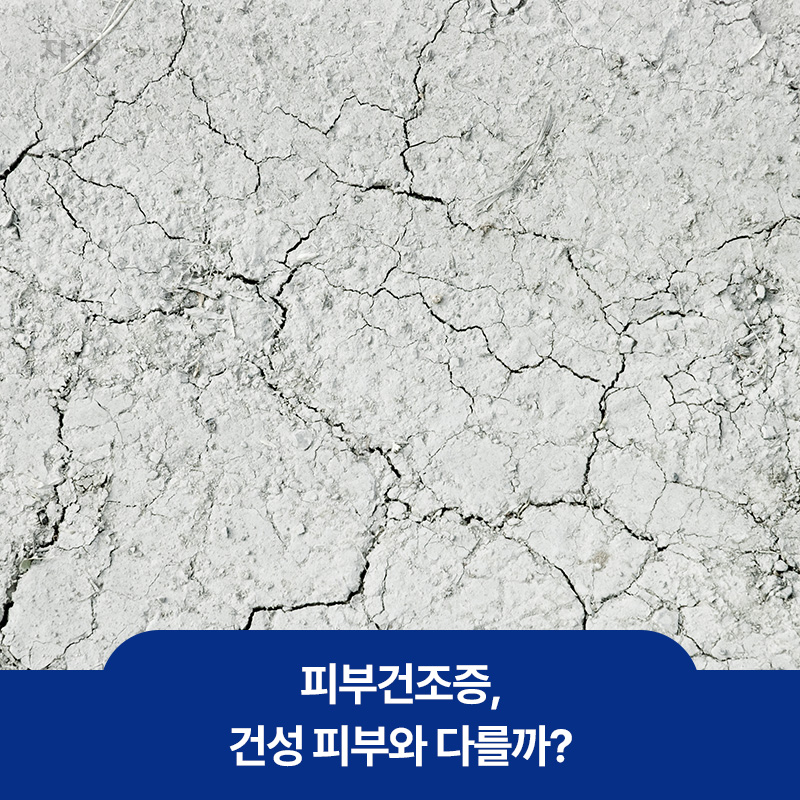 건조한 피부처럼 갈라져있는 땅 이미지