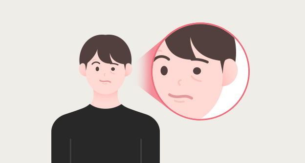 안면마비, 20대는 괜찮을까? - 자생의료재단