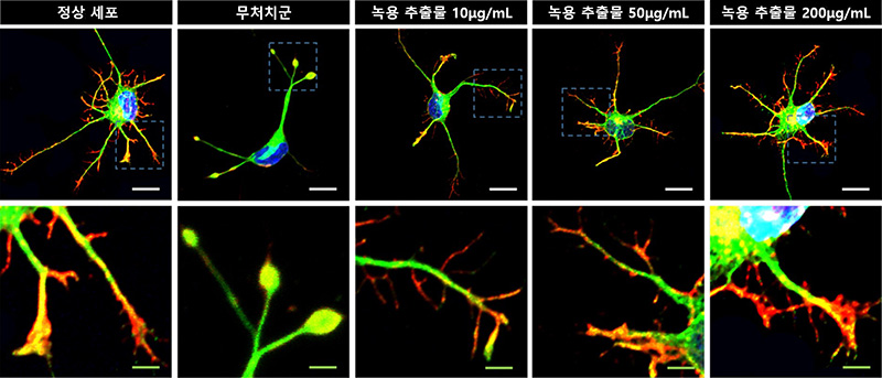 고배율 현미경 관찰 상 과산화수소 처리돼 손상을 유도한 신경세포에서는 타원 모양의 수축전구가 발견됐지만 녹용 추출물을 처리한 신경세포에서는 농도에 따라 재생이 유도돼 축삭돌기가 회복ㆍ증가했다 | 자생한방병원·자생의료재단