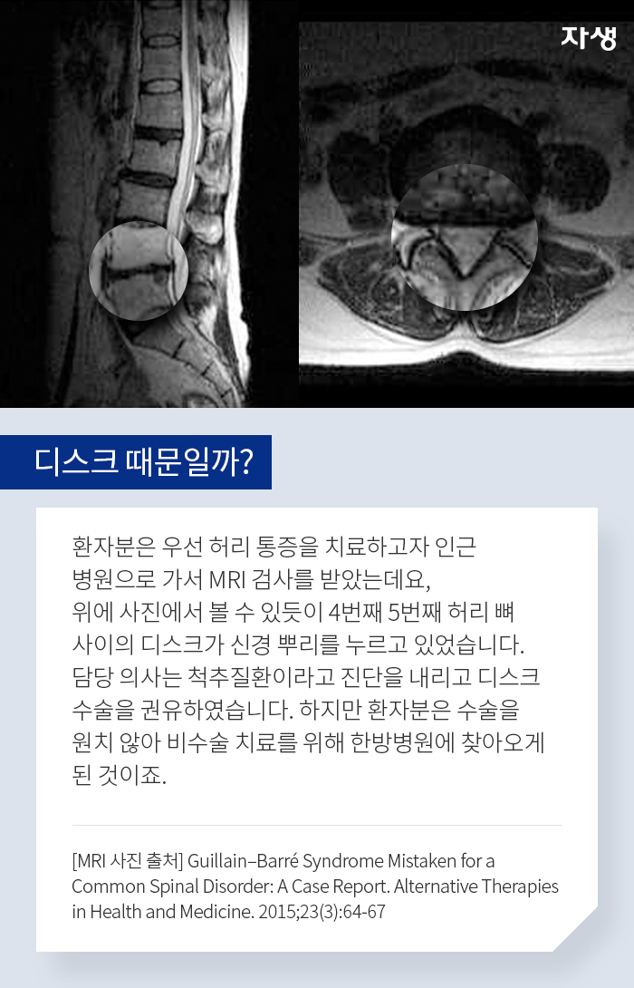 디스크 때문일까? - 알기 쉬운 연구 이야기 | 자생의료재단