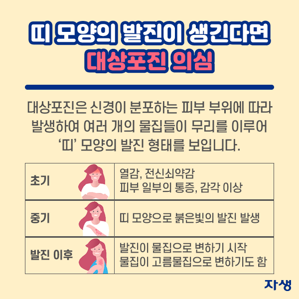 띠 모양의 발진이 생긴다면 대상포진 의심  | 자생한방병원·자생의료재단