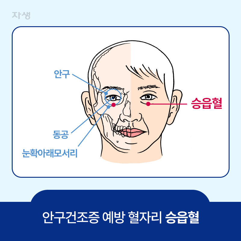 안구건조정 예방 혈자리 승읍혈 위치 이미지