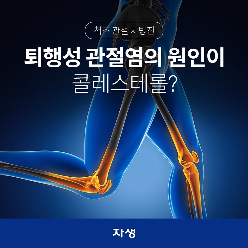 퇴행성 관절염의 원인이 콜레스테롤?  | 자생한방병원·자생의료재단