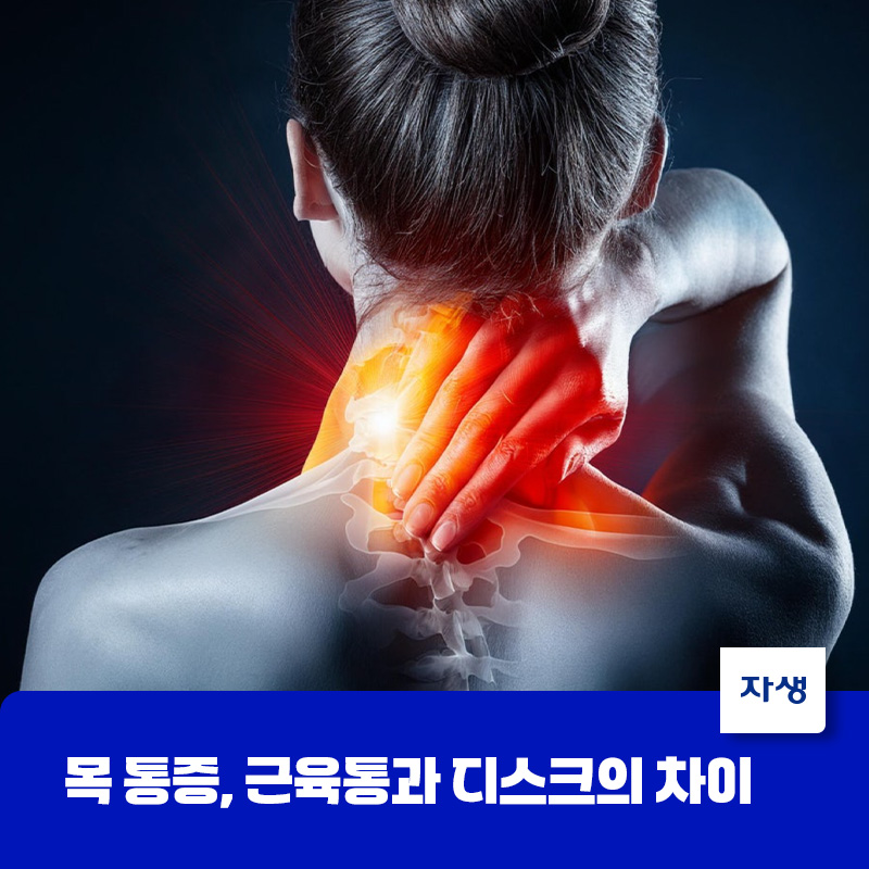 목 통증 원인, 근육통과 목디스크 차이