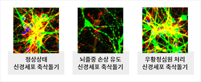 좋다고 알려진 우황청심원, 뇌졸중 예방 효과 실제로 밝혀져 | 자생한방병원・자생의료재단