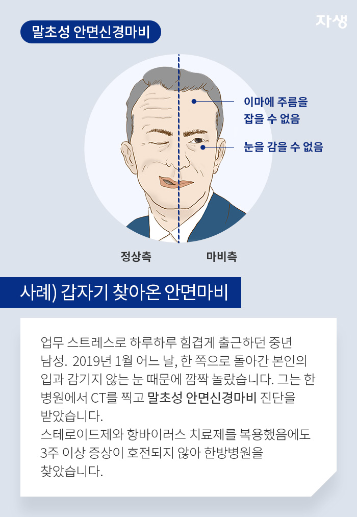 말초성 안면신경마비 (사례) 갑자기 찾아온 안면마비 - 업무 스트레스로 하루하루 힘겹게 출근하던 중년 남성.  2019년 1월 어느 날, 한 쪽으로 돌아간 본인의 입과 감기지 않는 눈 때문에 깜짝 놀랐습니다. 그는 한 병원에서 CT를 찍고 말초성 안면신경마비 진단을 받았습니다. 스테로이드제와 항바이러스 치료제를 복용했음에도 3주 이상 증상이 호전되지 않아 한방병원을 찾았습니다.