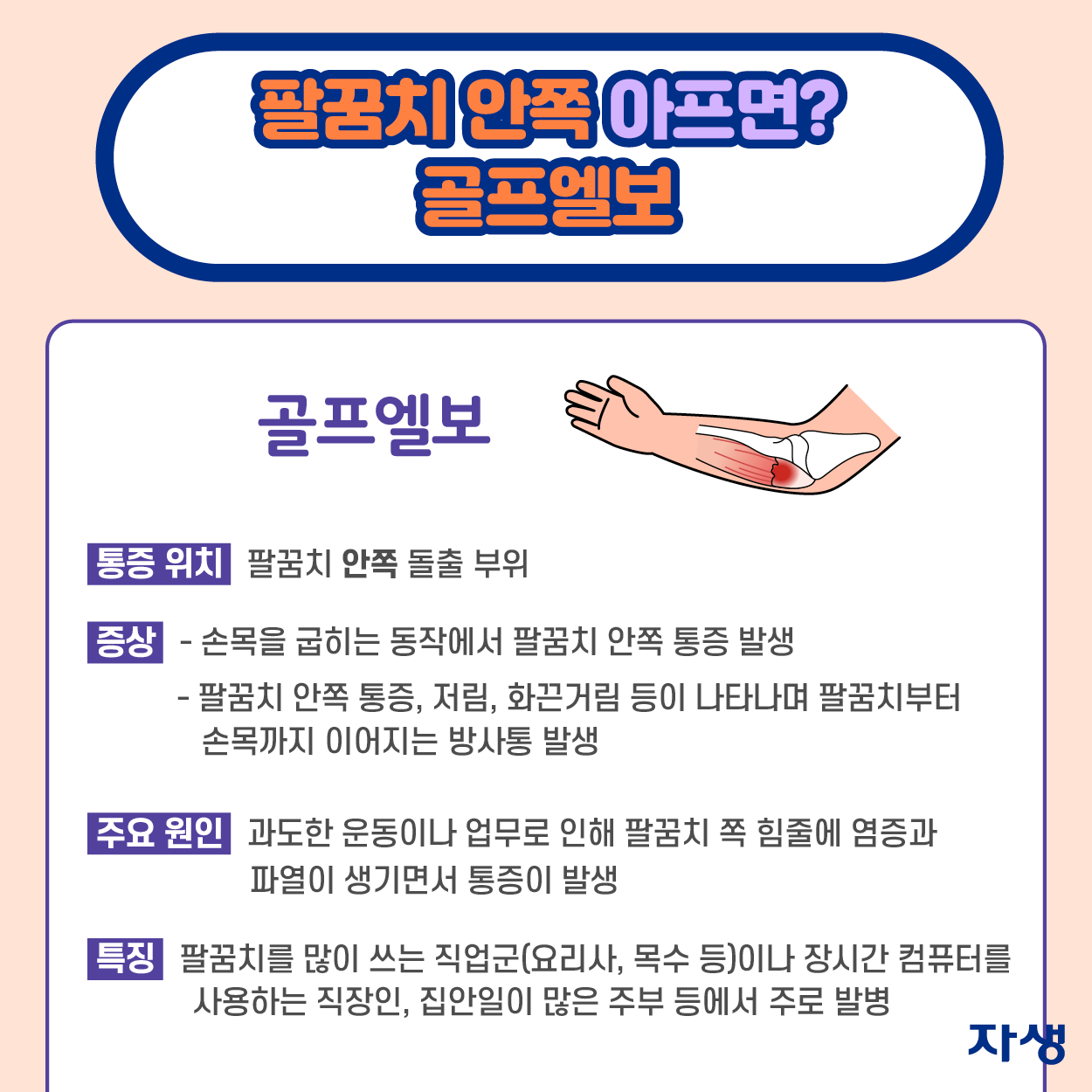 팔꿈치 안쪽 아프면? 골프엘보 ·통증위치: 팔꿈치 안쪽 돌출 부위 ·증상: 손목을 굽히는 동작에서 팔꿈치 안쪽 통증 발생, 팔꿈치 안쪽 통증, 저림, 화끈거림 등이 나타나며 팔꿈치부터 손목까지 이어지는 방사통 발생 ·주요 원인: 과도한 운동이나 업무로 인해 팔꿈치 쪽 힘줄에 염증과 파열이 생기면서 통증이 발생 ·특징: 팔꿈치를 많이 쓰는 직업군(요리사, 목수 등)이나 장시간 컴퓨터를 사용하는 직장인, 집안일이 많은 주부 등에서 주로 발병 | 자생한방병원·자생의료재단