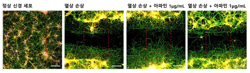 고배율 현미경 관찰 상 열상 손상을 가한 신경세포와 비교해 아파민을 처리한 신경세포에서는 아파민 농도가 높을수록 축삭돌기의 재생량과 길이가 증가했다 | 자생한방병원·자생의료재단