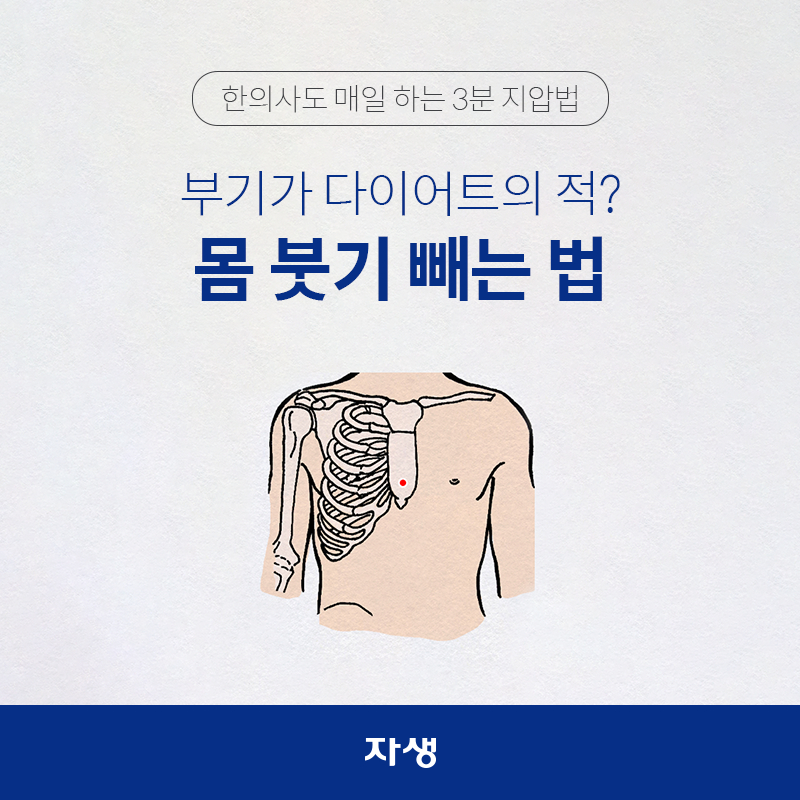 타이틀 이미지 : 한의사도 매일 하는 3분 지압법 - 부기가 다이어트의 적? 몸 붓기 빼는 법 | 자생한방병원·자생의료재단