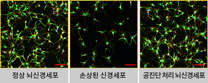 자생한방병원 척추관절연구소 자생공진단 | 자생한방병원·자생의료재단