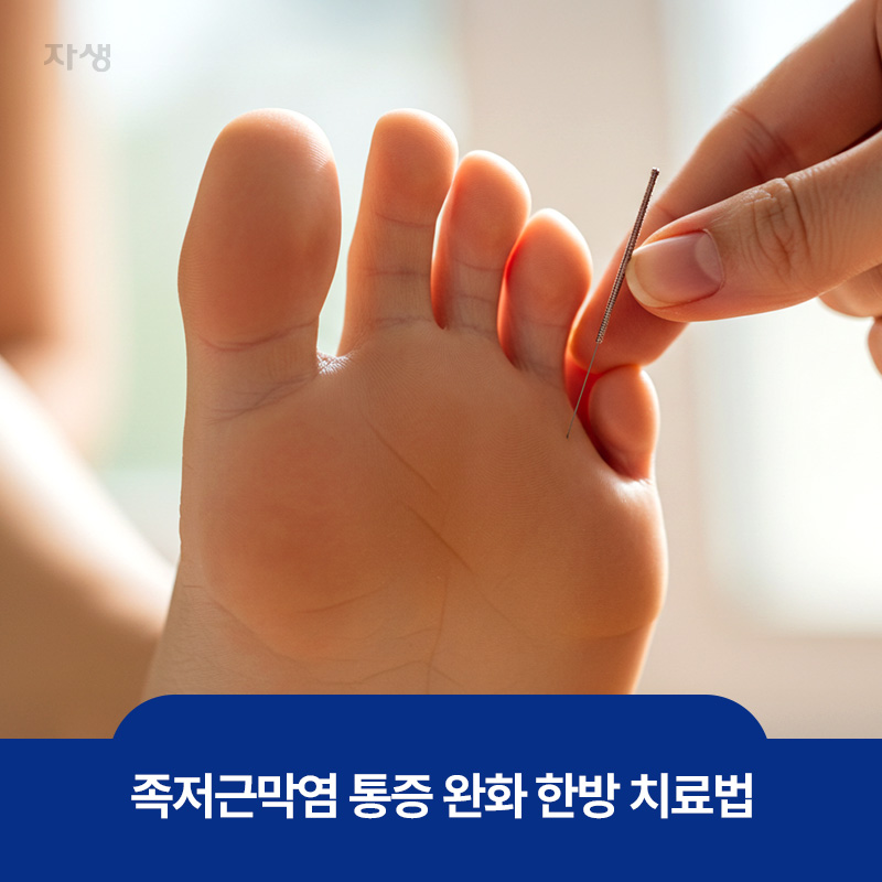 족저근막염 통증 완화를 위한 발바닥 침 치료 이미지