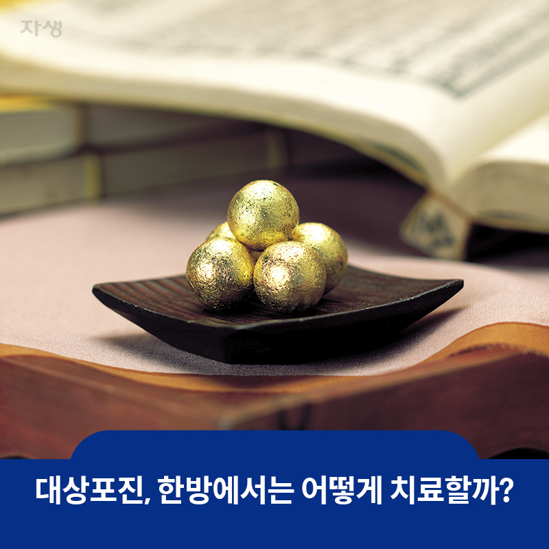 참고 이미지: 대상포진, 한방에서는 어떻게 치료할까? | 자생한방병원·자생의료재단