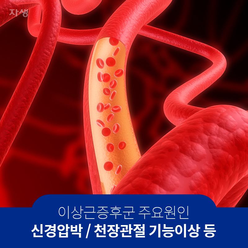 이상근증후군 주요원인 신경압박 / 천장관절 기능이상 등 | 자생한방병원ㆍ자생의료재단