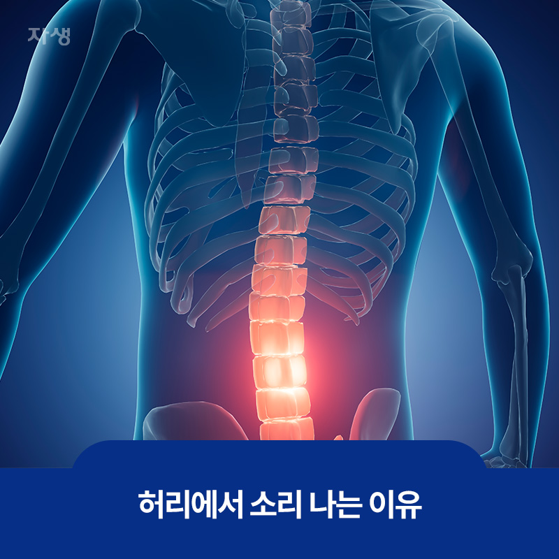 허리에서 소리나는 이유를 설명하기 위한 척추뼈 이미지