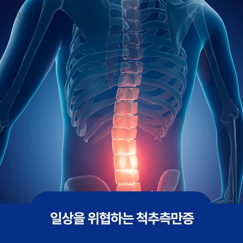 척추뼈가 휘어져 있는 모습
