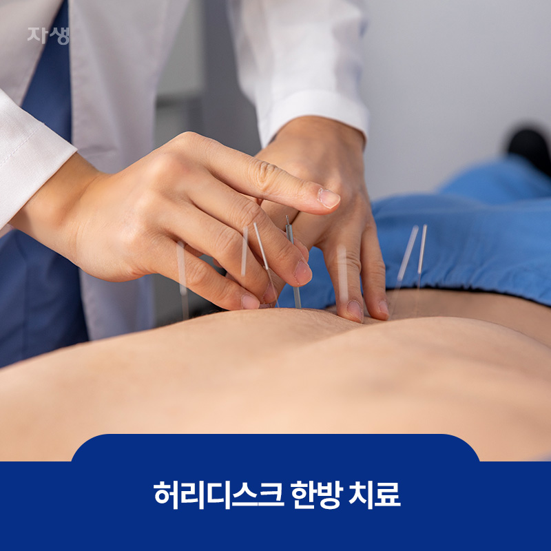 허리디스크 한방 치료 방법인 침 치료 이미지