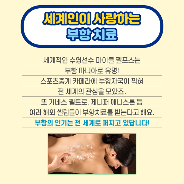 참고 이미지 : 세계인이 사랑하는 부항 치료 세계적인 수영선수 마이클 펠프스는 부항 마니아로 유명! 스포츠 중계 카메라에 부항자국이 찍혀 전 세계의 관심을 모았죠. 또 기네스 펠트로, 제니퍼 애니스톤 등 여러 해외 셀럽들이 부항치료를 받는다고 해요. 부항의 인기는 전 세계로 퍼지고 있답니다! | 자생한방병원·자생의료재단