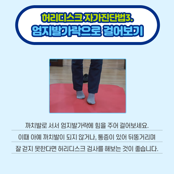 참고 이미지 : 허리디스크 자가진단법3. 엄지발가락으로 걸어보기 까치발로 서서 엄지발가락에 힘을 주어 걸어보세요. 이때 아예 까치발이 되지 않거나, 통증이 있어 뒤뚱거리며 잘 걷지 못한다면 허리디스크 검사를 해보는 것이 좋습니다. | 자생한방병원·자생의료재단