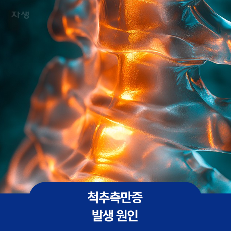 척추측만증 발생 원인을 설명하기 위한 확대된 척추뼈 이미지