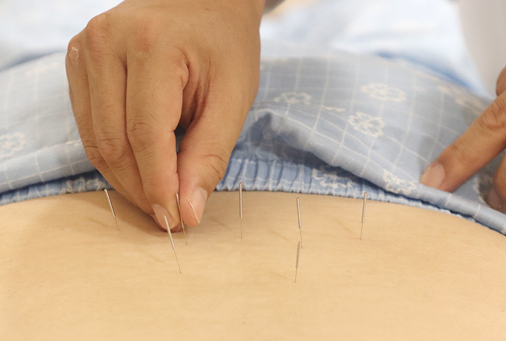 자생한방병원 의료진이 허리 통증을 호소하는 환자에게 침 치료를 실시하고 있다 (출처 : 자생한방병원) | 자생한방병원・자생의료재단