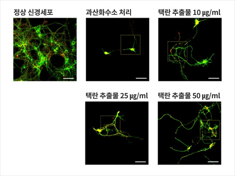 고배율 현미경 관찰 상 과산화수소(H2O2)가 처리된 신경세포는 축삭돌기가 끊어졌지만 택란 추출물을 처리한 신경세포에서는 농도에 따라 증가 및 재생이 유도돼 축삭돌기가 회복됐다 | 자생한방병원·자생의료재단