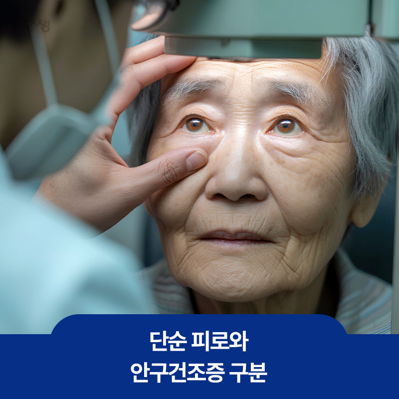 단순 피로와 안구건조증 증상 구분을 위해 한 노인의 눈을 장비를 통해 살펴보고 있는 건강정보 이미지