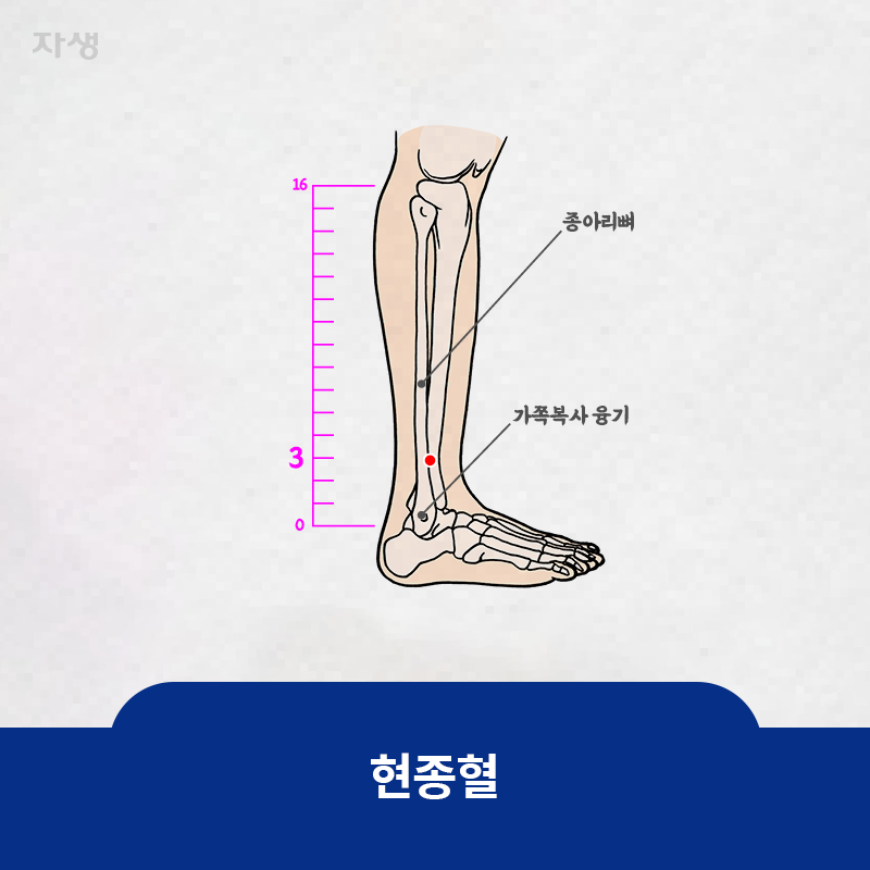 참고 이미지: 현종혈 | 자생한방병원·자생의료재단