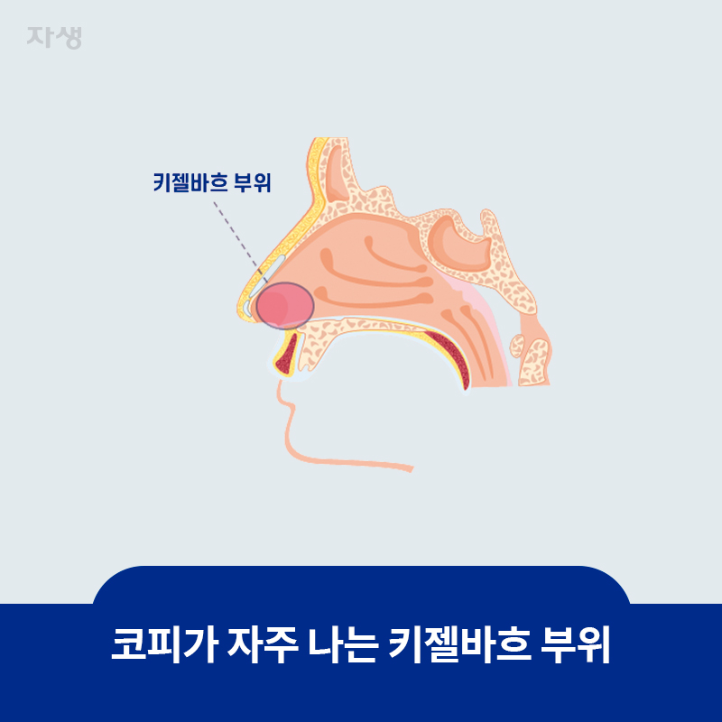 참고 이미지 : 코피가 자주 나는 키젤바흐 부위 | 자생한방병원·자생의료재단