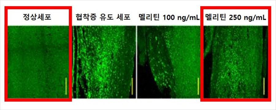 쥐의 실리콘 이식 부위에 집중됐던 염증성 대식세포가 멜리틴 투여에 의해 농도 의존적으로 감소했다.  | 자생한방병원・자생의료재단 