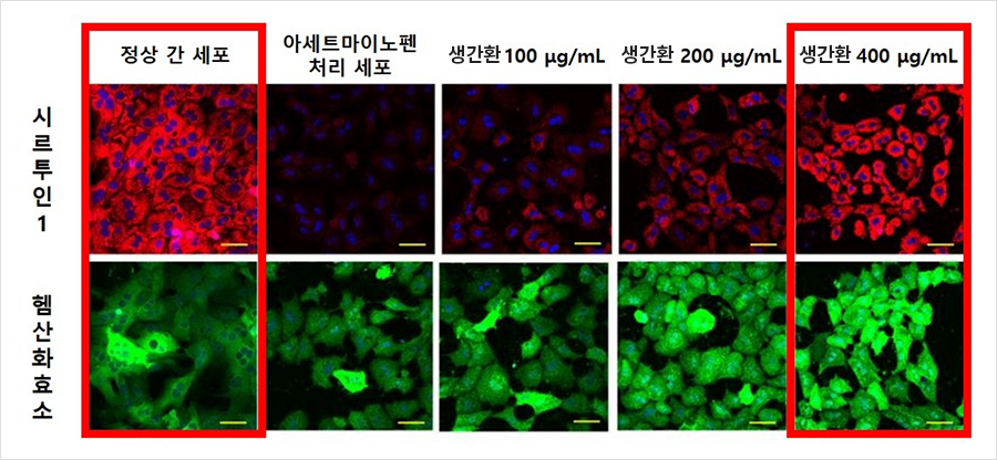 생간환 농도가 높아질수록 시르투인1의 발현이 증가함에 따라 형광염색이 더욱 선명해졌으며 헴산화효소 또한 생간환에 농도의존적으로 발현이 증가했다. | 자생한방병원・자생의료재단 