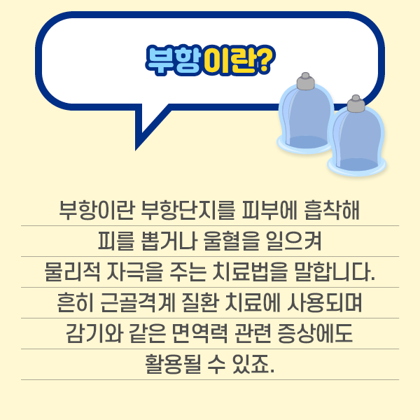 참고 이미지 : 부항이란 부항단지를 피부에 흡착해 피를 뽁거나 울혈을 일으켜 물리적 자극을 주는 치료법을 말합니다. 흔히 근골격계 질환 치료에 사용되며 감기와 같은 면역력 과녈ㄴ 증상에도 활용될 수 있죠. | 자생한방병원·자생의료재단