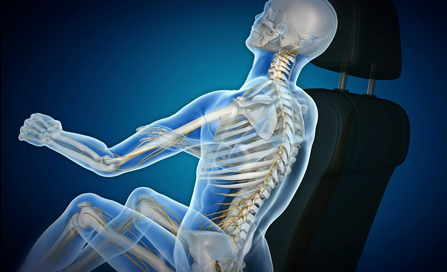 교통사고 충격은 척추에 손상을 야기해 급성 요통을 발생시키는 경우가 잦다 | 자생한방병원・자생의료재단