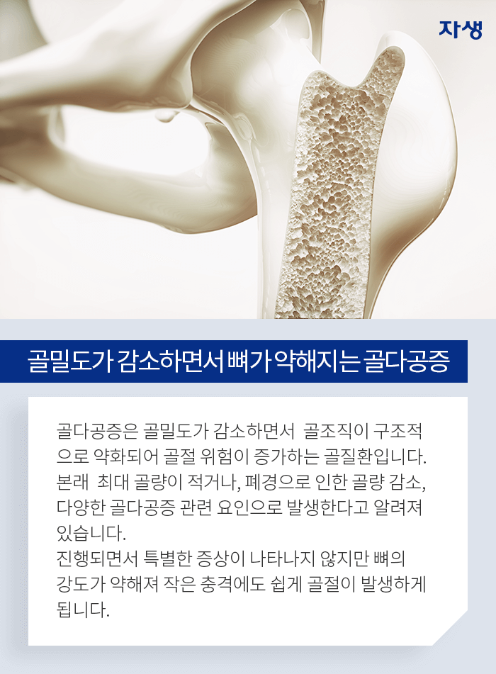 골밀도가 감소하면서 뼈가 약해지는 골다공증 - 골다공증은 골밀도가 감소하면서 골조직이 구조적으로 약화되어 골절 위험이 증가하는 골질환입니다. 본래 최대 골량이 적거나, 폐경으로 인한 골량 감소, 다양한 골다공증 관련 요인으로 발생한다고 알려져있습니다. 진행되면서 특별한 증상이 나타나지 않지만 뼈의 강도가 약해져 작은 충격에도 쉽게 골졸이 발생하게 됩니다.