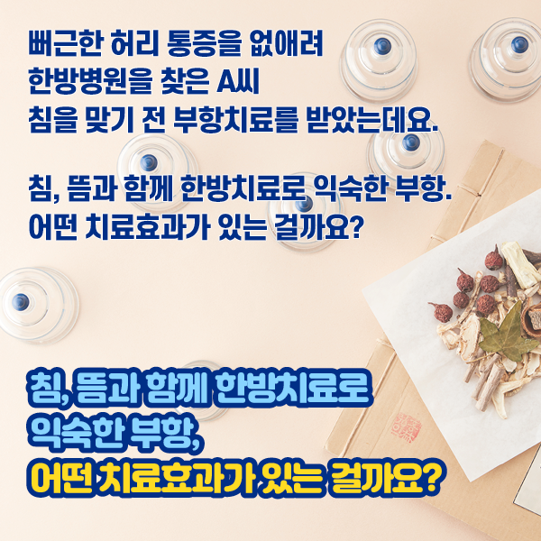 참고 이미지 : 뻐근한 허리 통증을 없애려 한방병원을 찾은 A씨 침을 맞기 전 부항치료를 받았는데요. 침, 뜸과 함께 한방치료로 익숙한 부항. 어떤 치료효과가 있는 걸까요? | 자생한방병원·자생의료재단