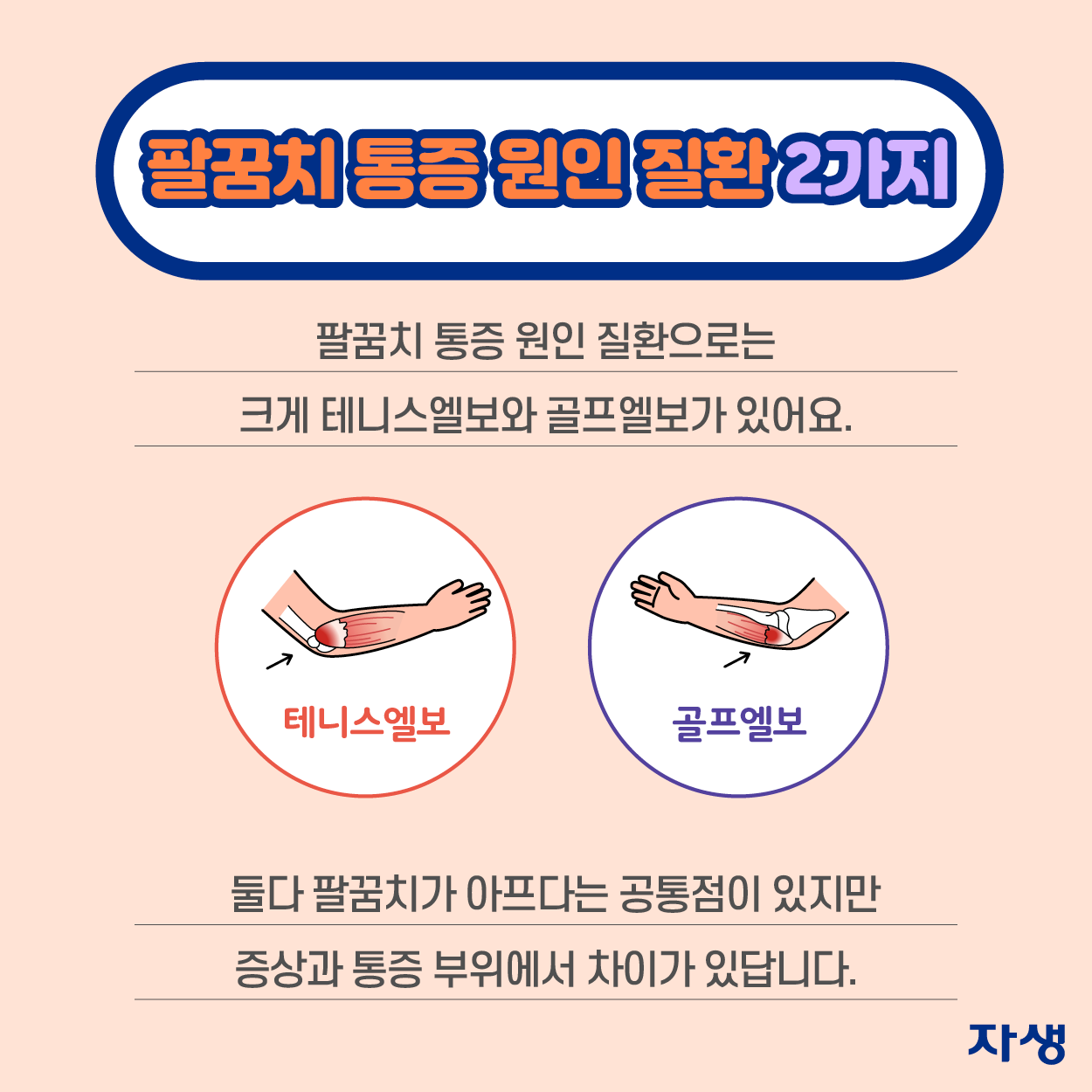 팔꿈치 통증 원인 질환 2가지 팔꿈치 통증 원인 질환으로는 크게 테니스 엘보와 골프 엘보가 있어요. 둘다 팔꿈치가 아프다는 공통점이 있지만 증상과 통증 부위에서 차이가 있답니다.  | 자생한방병원·자생의료재단