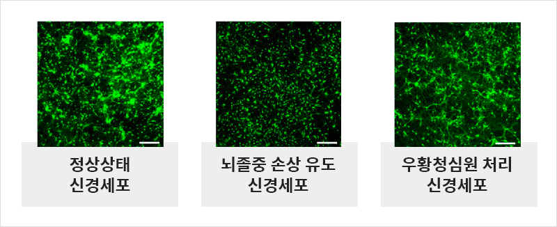 좋다고 알려진 우황청심원, 뇌졸중 예방 효과 실제로 밝혀져 | 자생한방병원・자생의료재단 