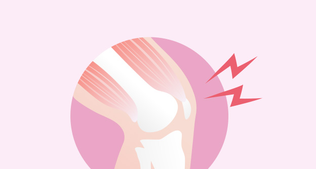허벅지 근육 약화, 무릎 관절염을 부른다? - 자생의료재단