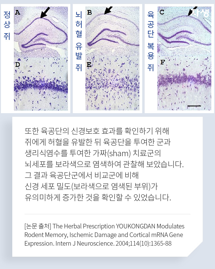 육공단의 신경보호 효과를 확인 - 알기 쉬운 연구 이야기 | 자생의료재단