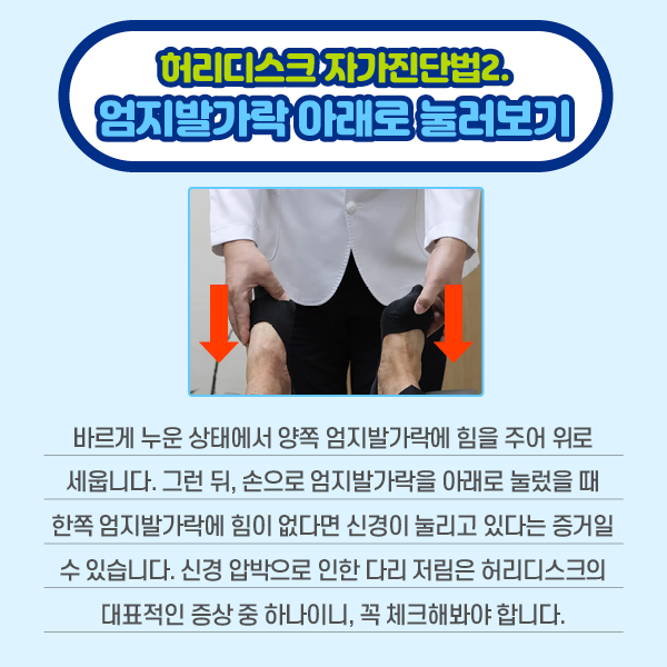 참고 이미지 : 허리디스크 자가진단법2. 엄지발가락 아래로 눌러보기 바르게 누운 상태에서 양쪽 엄지발가락에 힘을 주어 위로 세웁니다. 그런 뒤, 손으로 엄지발가락을 아래로 눌렀을 때 한쪽 엄지발가락에 힘이 없다면 신경이 눌리고 있다는 증거일 수 있습니다. 신경 압박으로 인한 다리 저림은 허리디스크의 대표적인 증상 중 하나이니, 꼭 체크해봐야 합니다. | 자생한방병원·자생의료재단