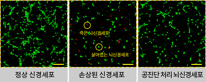 자생한방병원 척추관절연구소 자생공진단 | 자생한방병원·자생의료재단