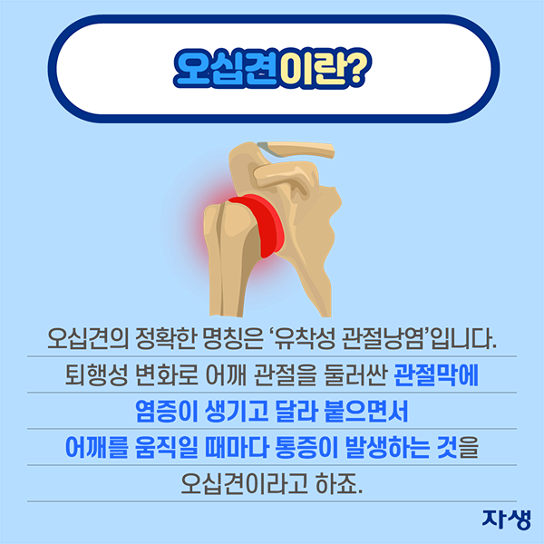 오십견이란? 오십견의 정확한 명칭은 '유착성 관절낭염'입니다. 퇴행성 변화로 어깨 관절을 둘러싼 관절막에 염증이 생기고 달라 붙으면서 어깨를 움직일 때마다 통증이 발생하는 것을 오십견이라고 하죠.  | 자생한방병원·자생의료재단