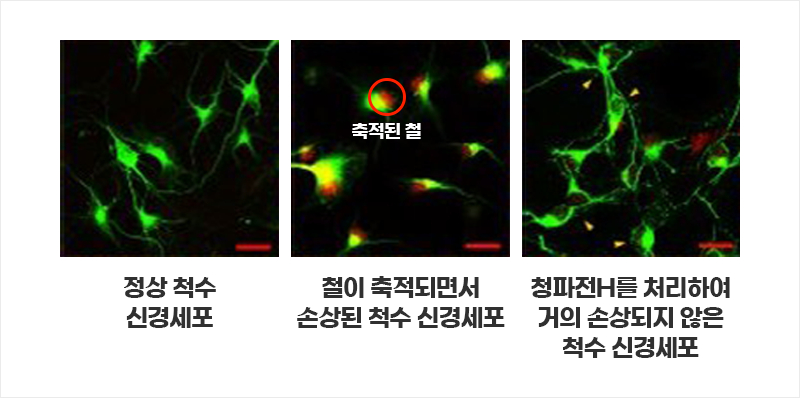 정상 척수 신경세포와 손상 척추 신경세포와 청파전H 처리 척수 신경세포 비교 | 자생한방병원·자생의료재단