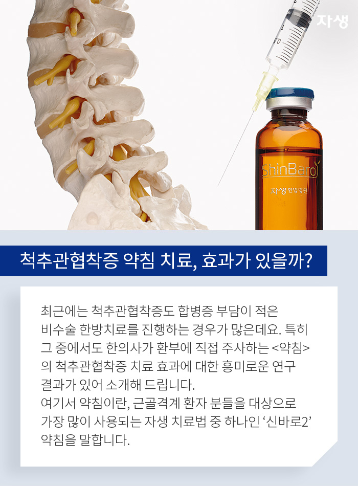 척추관협착증 약침 치료, 효과가 있을까? - 최근에는 척추관협착증도 합병증 부담이 적은 비수술 한방치료를 진행하는 경우가 많은데요. 특히 그 중에서도 한의사가 환부에 직접 주사하는 약침의 척추관협착증 치료 효과에 대한 흥미로운 연구 결과가 있어 소개해 드립니다. 여기서 약침이란, 근골격계 환자분들을 대상으로 가장 많이 사용되는 자생 치료법 중 하나인 신바로2 약침을 말합니다.