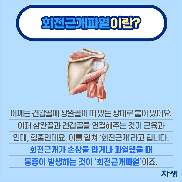 회전근개파열이란? 어깨는 견갑골에 상완골이 떠 있는 상태로 붙어 있어요. 이때 상완골과 견갑골을 연결해주는 것이 근육과 인대, 힘줄인데요. 이를 합쳐 '회전근개'라고 합니다. 회전근개가 손상을 입거나 파열됐을 떄 통증이 발생하는 것이 '회전근개파열'이죠. | 자생한방병원·자생의료재단