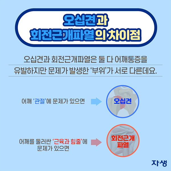 오십견과 회전근개파열의 차이점 - 오십견과 회전근개파열은 둘다 어깨통증을 유발하지만 문제가 발생한 '부위'가 서로 다른데요. 어깨'관절'에 문제가 있으면 → 오십견 / 어깨를 둘러싼 '근육과 힘줄'에 문제가 있으면 → 회전근개파열 | 자생한방병원·자생의료재단