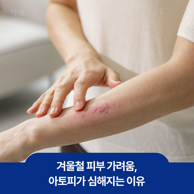 겨울철 유독 가려움이 심해지는 아토피 피부 팔 이미지