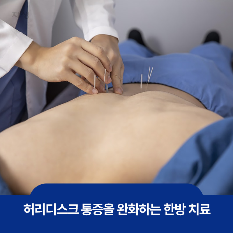 허리디스크 통증 완화를 위한 한방 침 치료 이미지