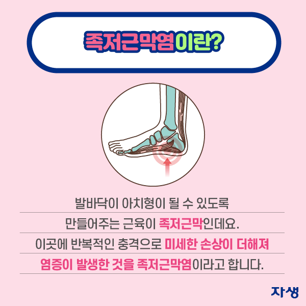 족저근막염이란? 발바닥이 아치형이 될 수 있도록 만들어주는 근육이 족저근막인데요. 이곳에 반복적으로 충격으로 미세한 손상이 더해져 염증이 발생한 것을 족저근막염이라고 합니다.| 자생한방병원·자생의료재단